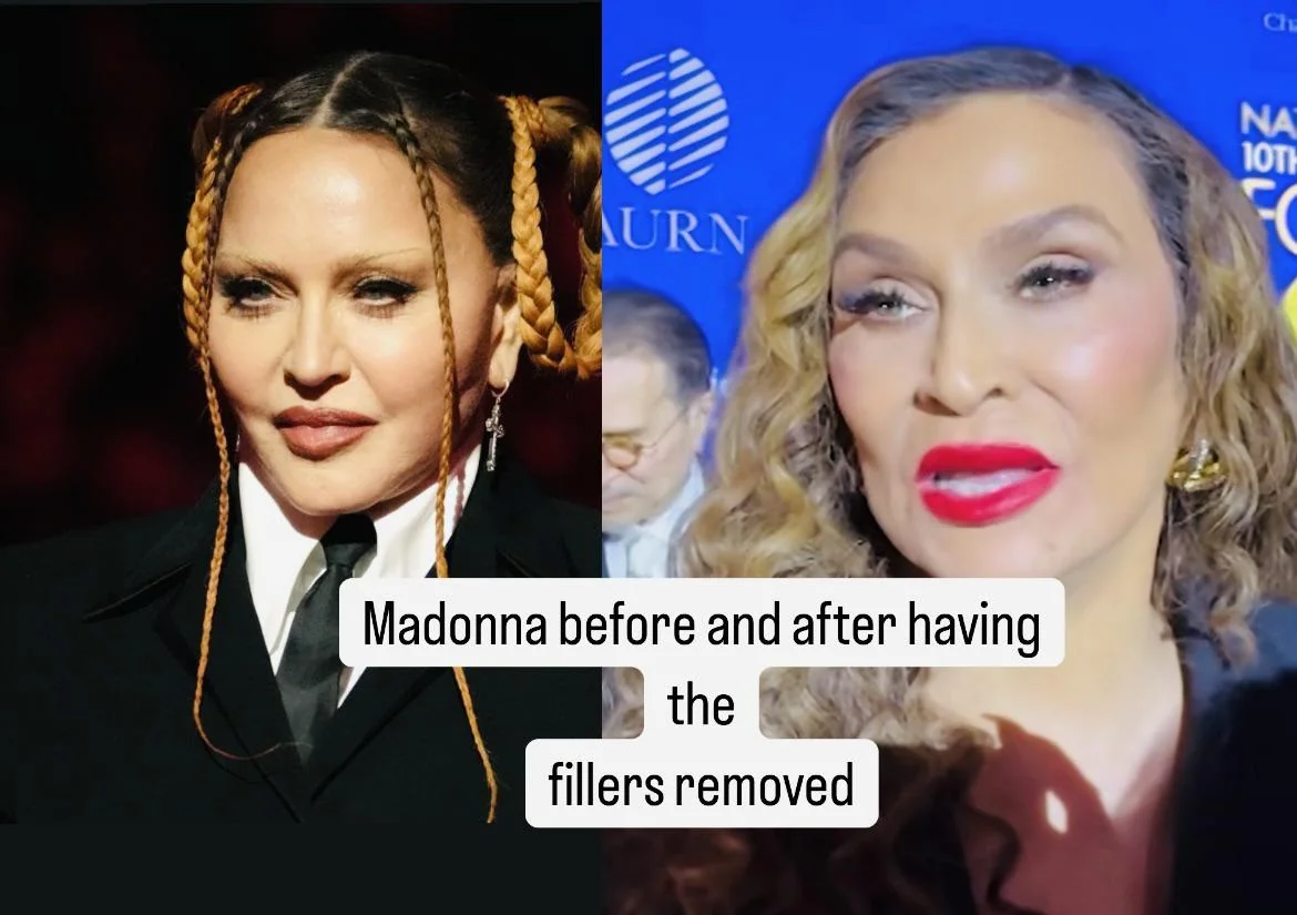 Madonna, 66. She is in her Queen B era. picture 1 of 1
