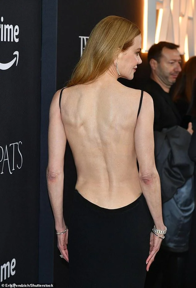 Nicole Kidman, 56 showing off her beautiful back in a sexy backless black Dress picture 2 of 6